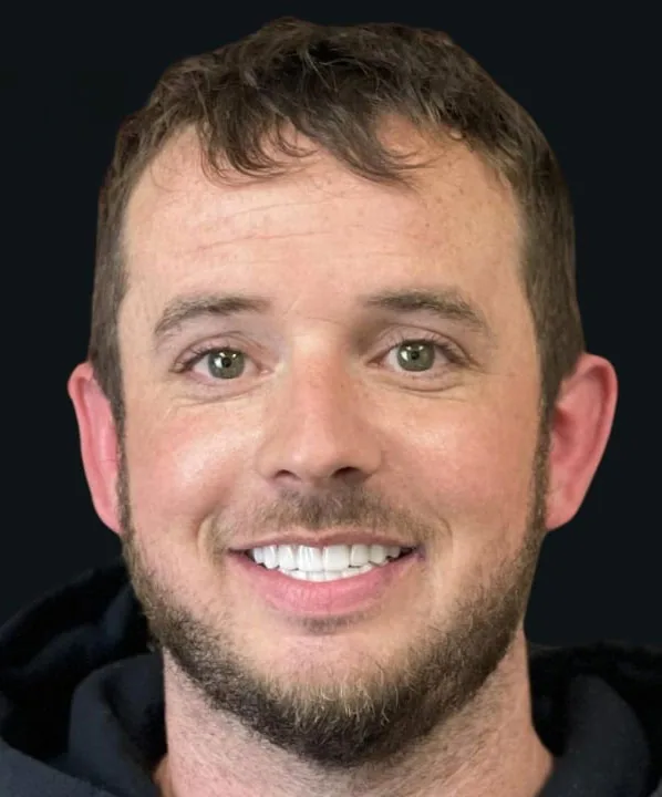 After: restored smile