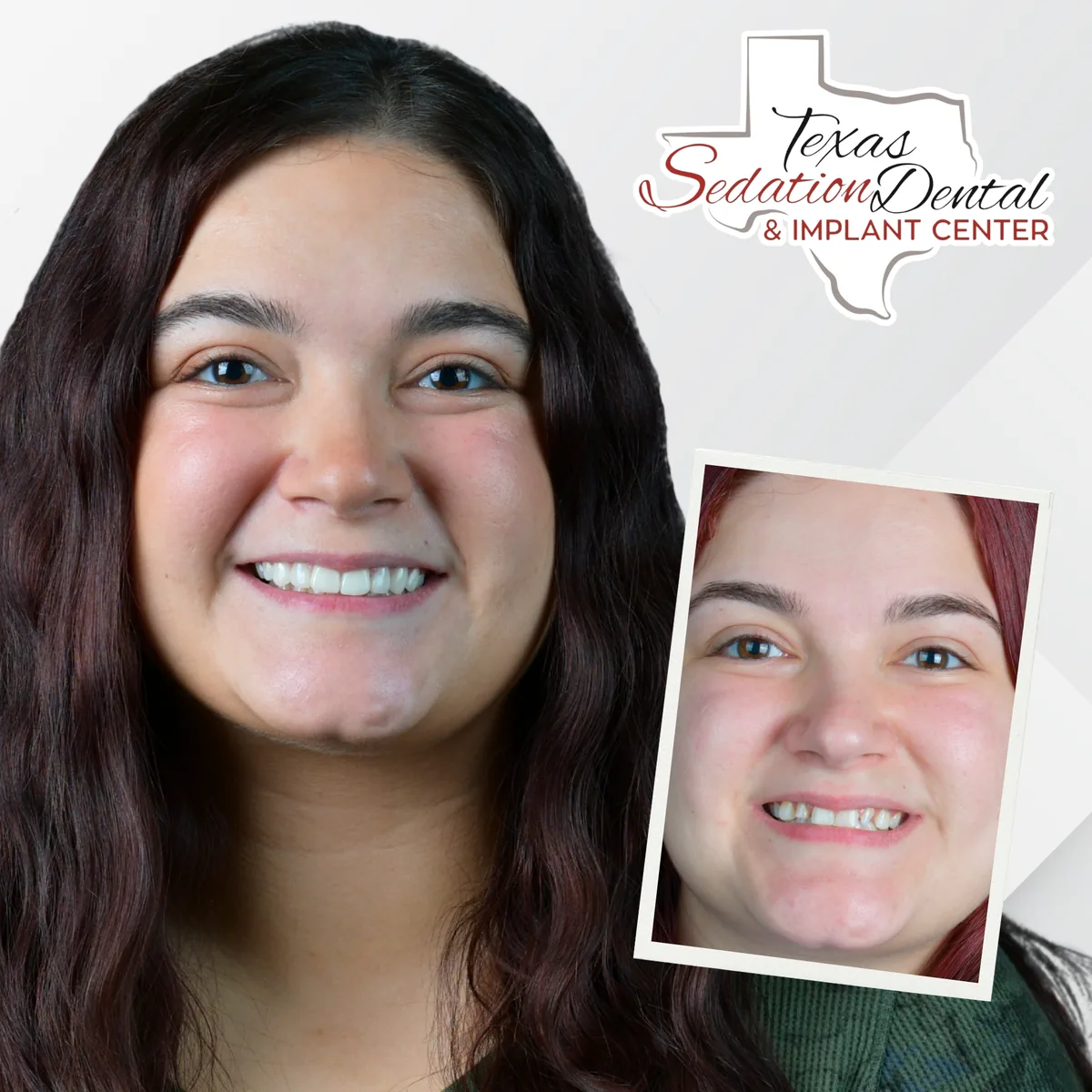 Patient before and after smile transformation