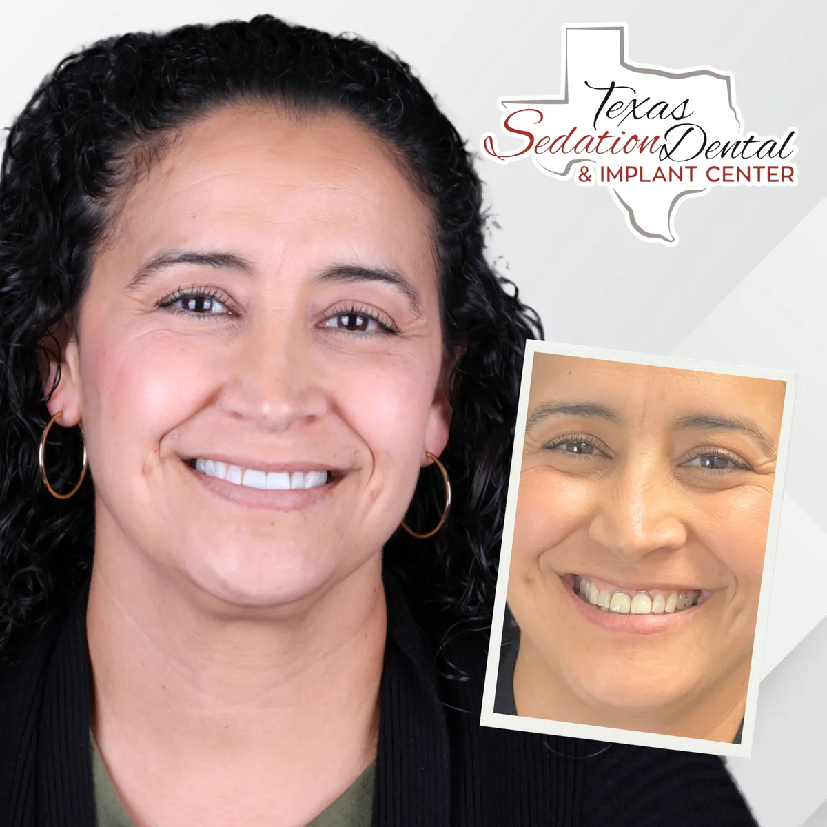 Patient before and after smile transformation