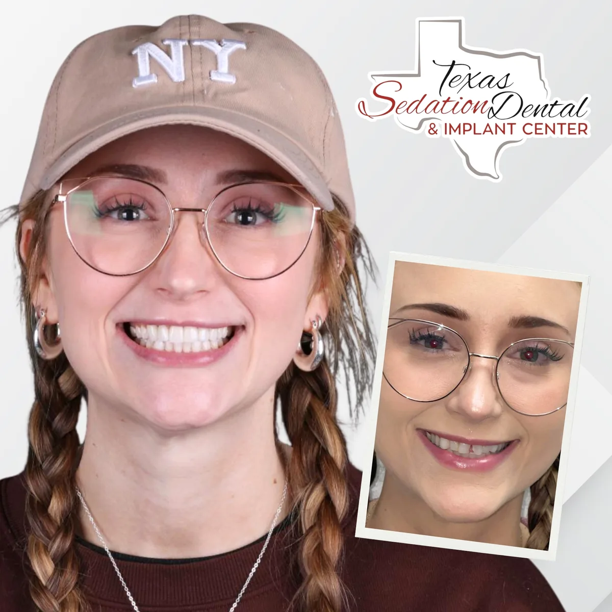 Patient before and after smile transformation