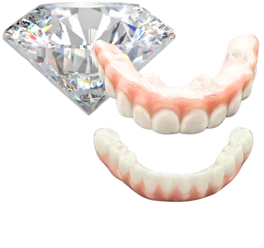 Diamond Level Ultimate Smile pricing tier