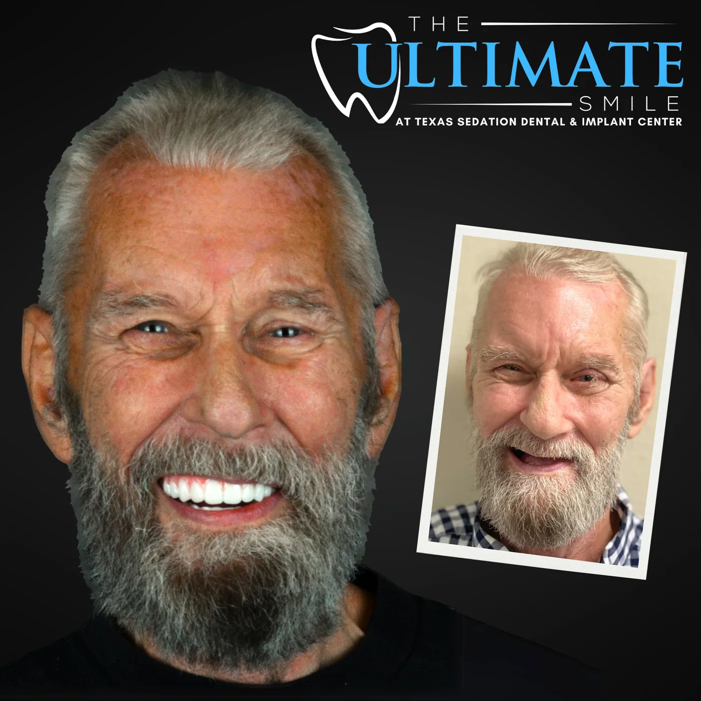 Patient before and after smile transformation