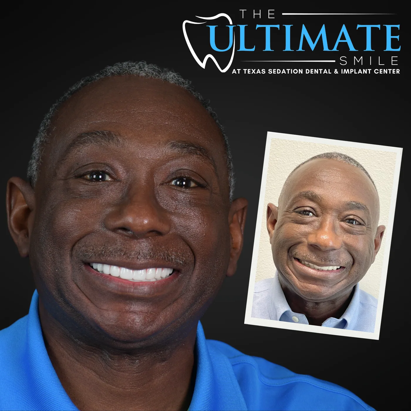 Patient before and after smile transformation
