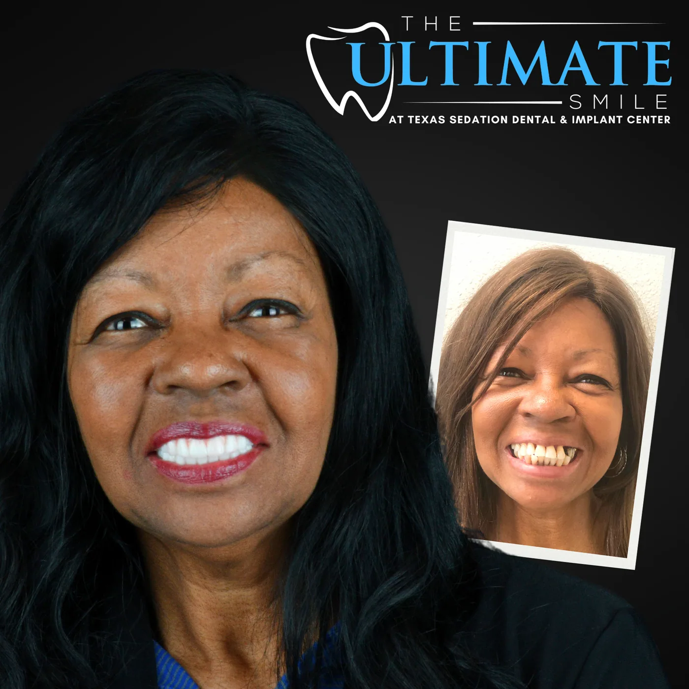 Patient before and after smile transformation