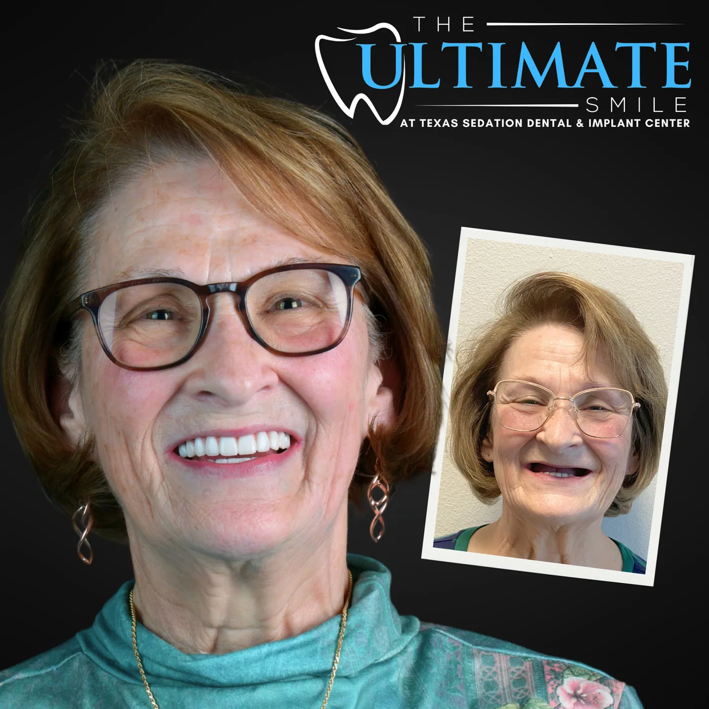 Patient before and after smile transformation