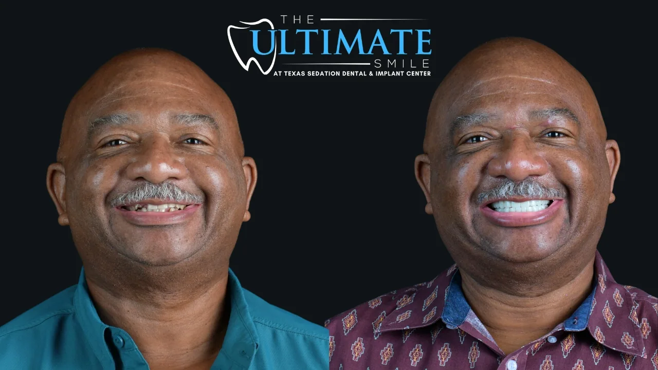 Patient before and after, Ultimate Smile transformation