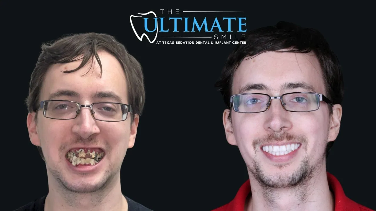Patient before and after, Ultimate Smile transformation