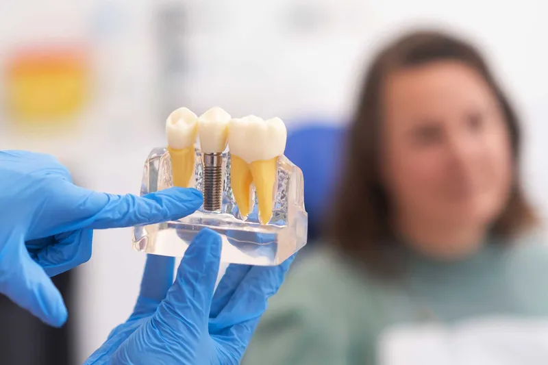 Dental Implants service tile
