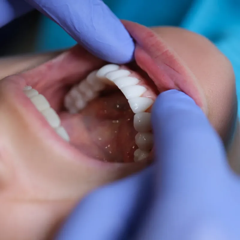 Periodontal Care service tile