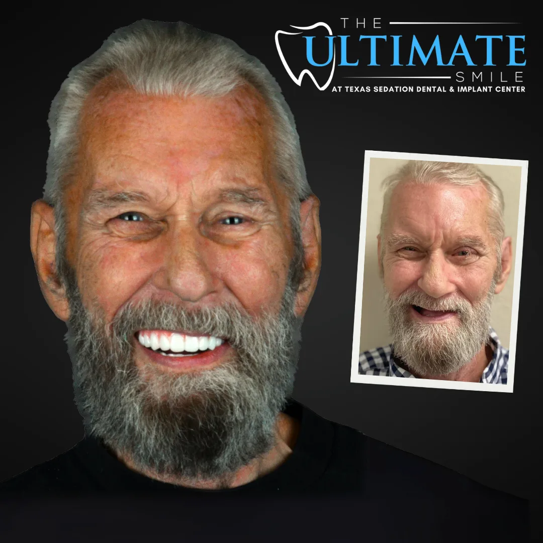 Before and after sedation dentistry smile transformation showing improved teeth and confidence